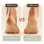 2025 Nouvel appareil USB rechargeable pour la réparation et le meulage des pieds