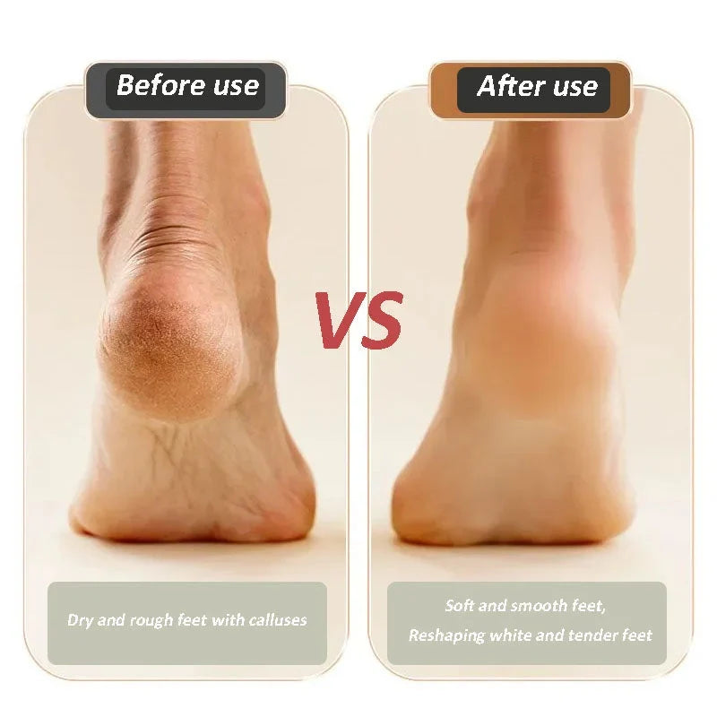 2025 Nouvel appareil USB rechargeable pour la réparation et le meulage des pieds