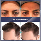 Kit de remplissage Barba Mattita - Améliore efficacement la pilosité faciale
