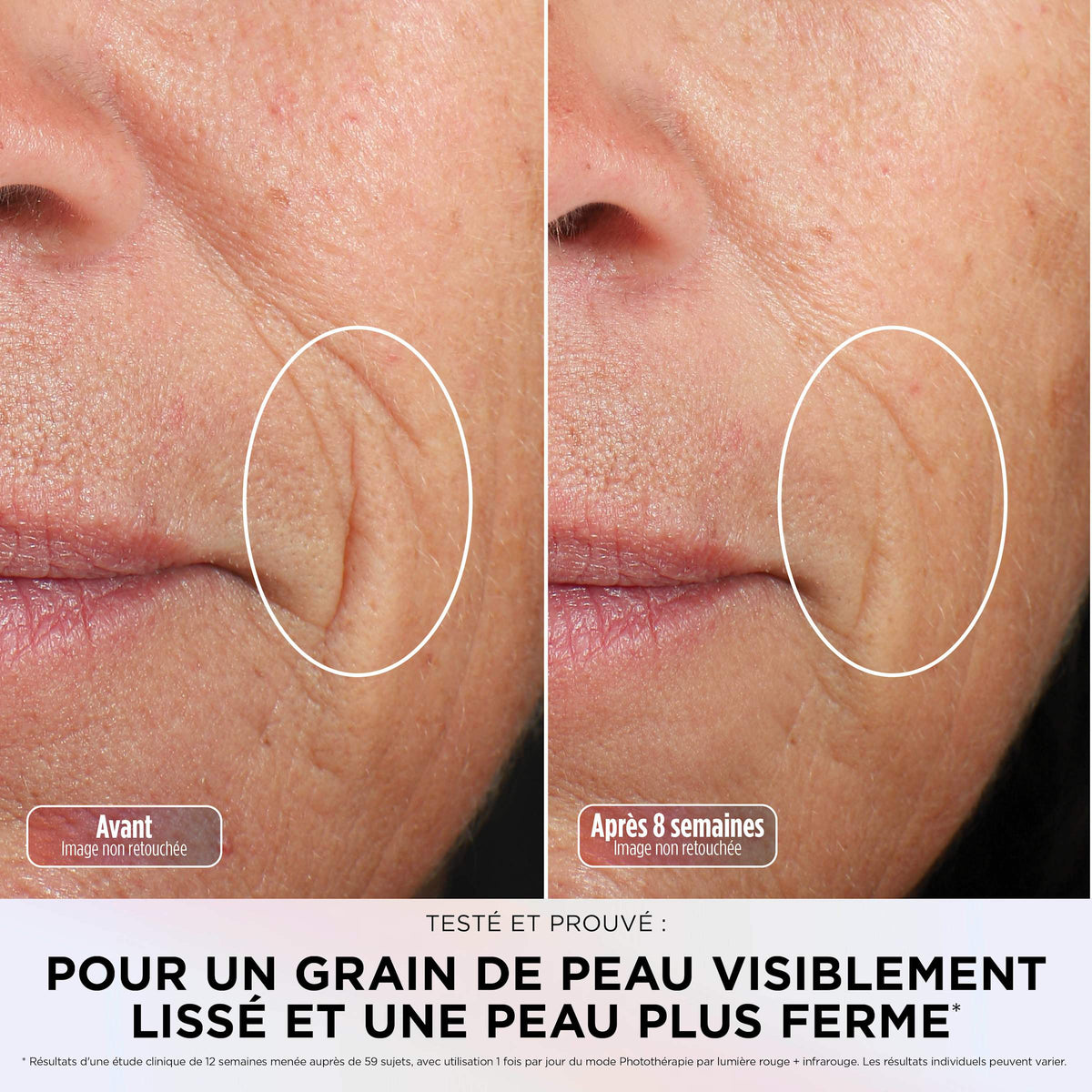 Masque LED Shark CryoGlow avec rafraîchissement du contour des yeux - Bleu Givré
