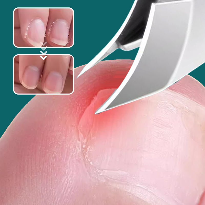 Lot de 3 Coupe-ongles Inclinés à 25° Anti-Projections