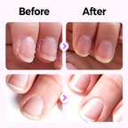 🌟ACHETEZ-EN 1 ET RECEVEZ-EN 1 GRATUITEMENT🌟Nouveau stylo de soin des ongles 3 en 1 ag