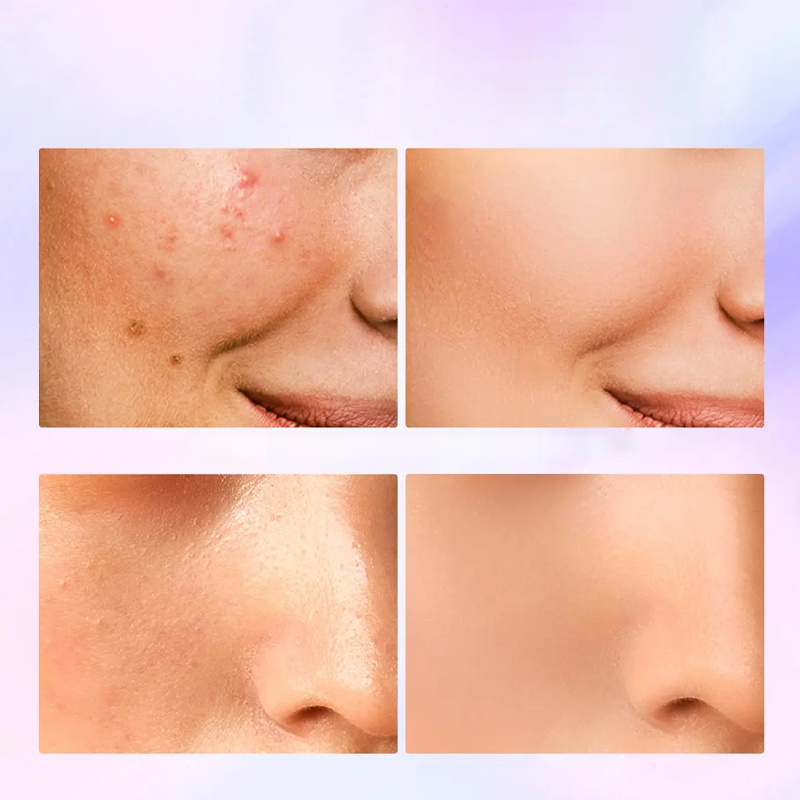 💜 Correcteur Crème Effet Mat – Couvre Imperfections & Cernes | Fini Velouté Naturel | Tenue 24H | Léger sur la Peau | 3 Teintes ✨💄